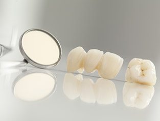 dental crowns and bridges on cabinet