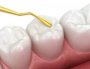 Digital image of a dental crown