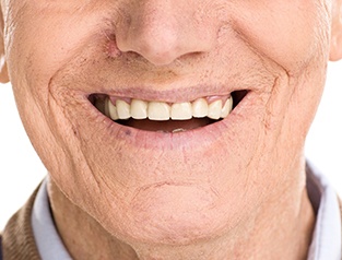 Older man smiling with dentures in Greenfield.