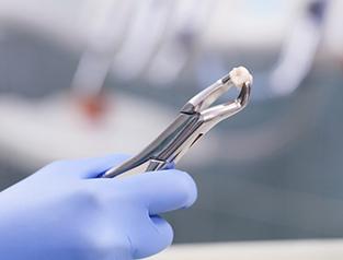A dentist holding an extracted tooth.