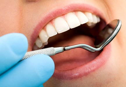 woman mouth open dental checkup