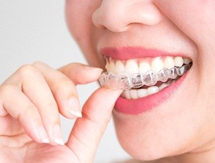 Closeup of patient putting in Invisalign in Greenfield
