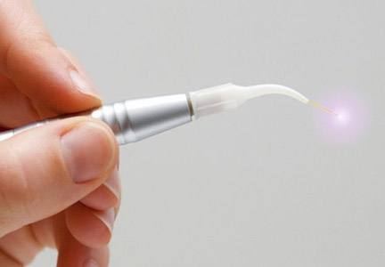 soft tissue laser