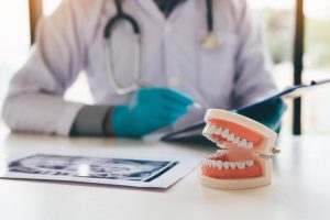 A model of dentures sitting on a table.