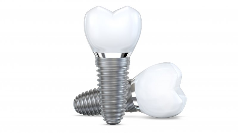 3D model of a dental implant