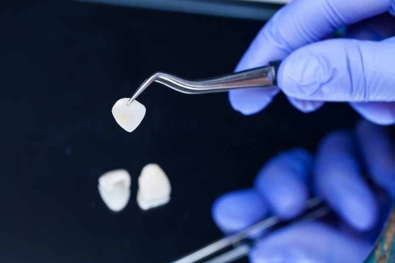 A dentist holding veneers with a tweezer