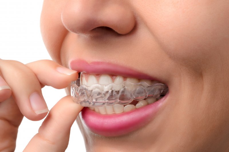 A woman putting in her Invisalign aligner