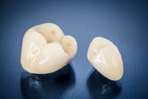 two dental crowns sitting on a table