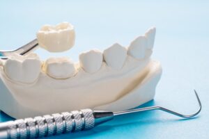 Dental crown and mouth mold with dental tools nearby.